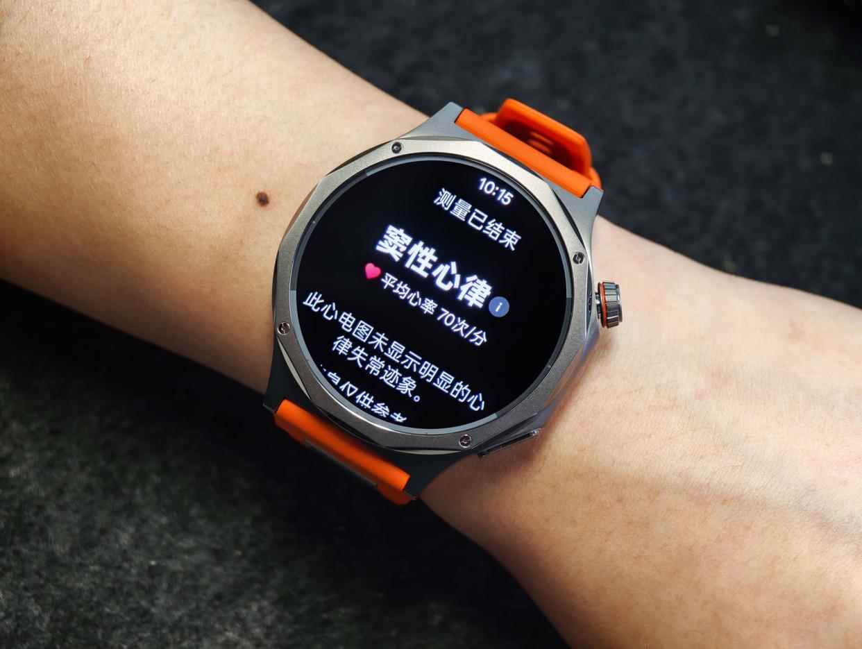 把健康管家+专业教练戴在手上! OPPO Watch X3智能手表首发评测